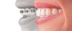 plano-odontologico-limeira-1438895849
