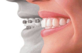 Dentical Dental Cooperativa Odontológica de Limeira - Foto 1